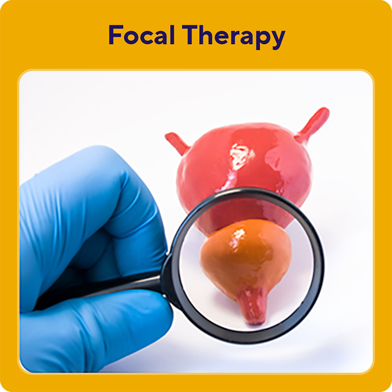 Focal Therapy illustration